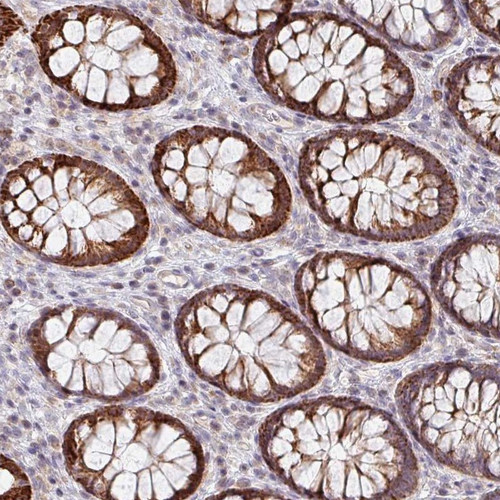 Immunohistochemical staining of human colon shows strong cytoplasmic positivity in glandular cells.