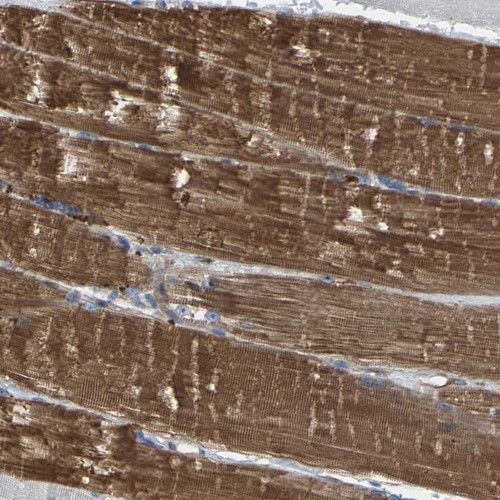 Immunohistochemical staining of human skeletal muscle shows distinct cytoplasmic positivity in myocytes.