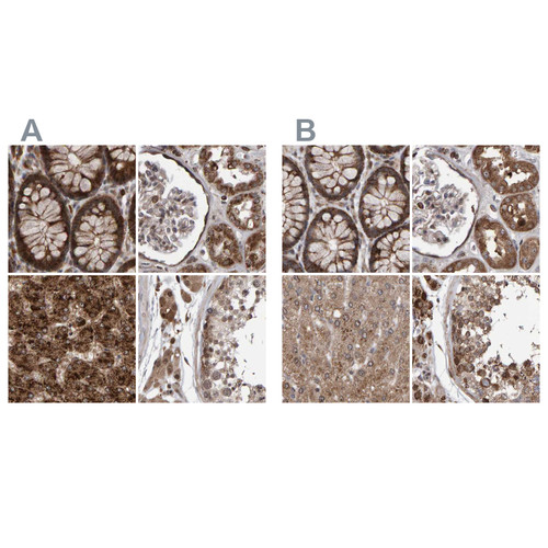 Immunohistochemical staining of human colon, kidney, liver and testis using Anti-PECR antibody HPA021593 (A) shows similar protein distribution across tissues to independent antibody HPA022539 (B).