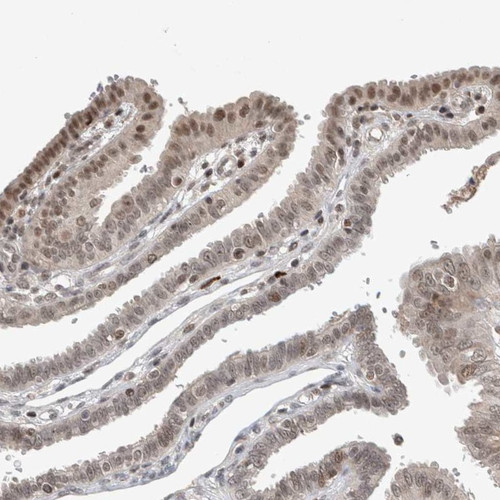 Immunohistochemical staining of human fallopian tube shows nuclear positivity in glandular cells.