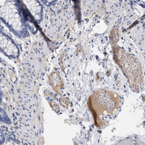 Immunohistochemical staining of human colon shows positivity in plasma.