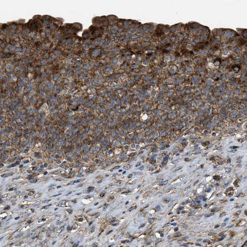 Immunohistochemical staining of human urinary bladder shows strong cytoplasmic positivity in urothelial cells.