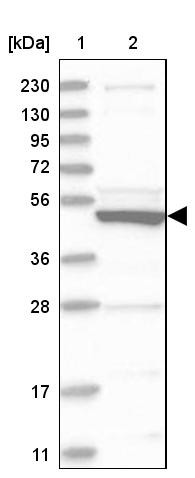 Lane 1: Marker [kDa] 230, 130, 95, 72, 56, 36, 28, 17, 11<br/>Lane 2: Human cell line RT-4
