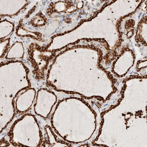 Immunohistochemical staining of human thyroid gland shows strong cytoplasmic positivity in glandular cells.