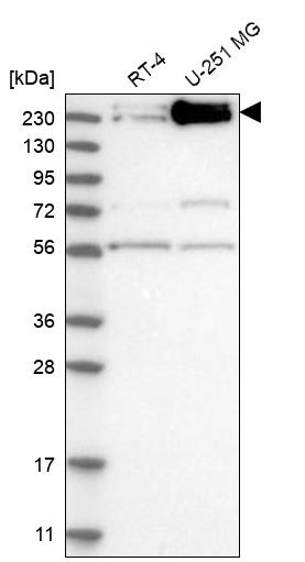 Western blot analysis in human cell line RT-4 and human cell line U-251 MG.