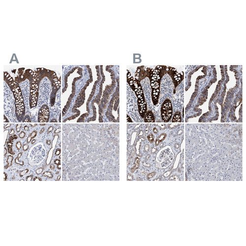 Immunohistochemical staining of human colon, fallopian tube, kidney and liver using Anti-MKS1 antibody HPA021812 (A) shows similar protein distribution across tissues to independent antibody HPA021372 (B).