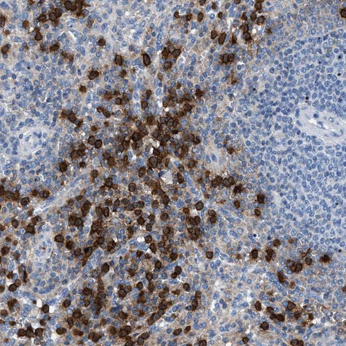 Immunohistochemical staining of human spleen shows strong cytoplasmic positivity in subsets of cells in the red pulp.