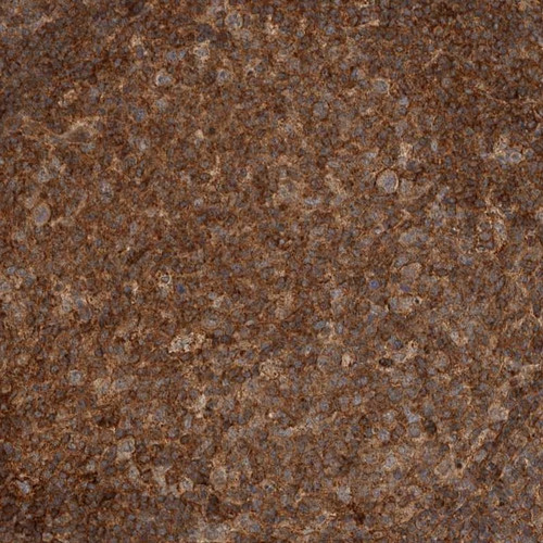 Immunohistochemical staining of human lymph node shows strong cytoplasmic positivity in reaction center cells.