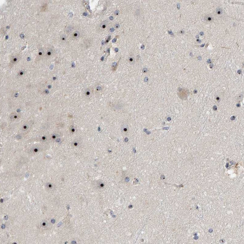 Immunohistochemical staining of human hippocampus shows strong nucleolar positivity in neuronal cells.