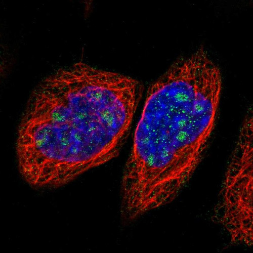 Immunofluorescent staining of human cell line A-431 shows localization to nucleoli.