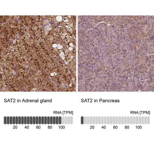 Immunohistochemistry analysis in human adrenal gland and pancreas tissues using Anti-SAT2 antibody. Corresponding SAT2 RNA-seq data are presented for the same tissues.