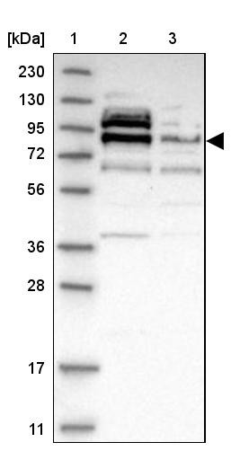 Lane 1: Marker [kDa] 230, 130, 95, 72, 56, 36, 28, 17, 11<br/>Lane 2: Human cell line RT-4<br/>Lane 3: Human cell line U-251MG sp