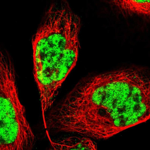Immunofluorescent staining of human cell line A-431 shows localization to nuclear speckles.