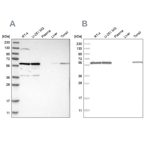 Western blot analysis using Anti-PRPF4 antibody HPA022248 (A) shows similar pattern to independent antibody HPA021794 (B).