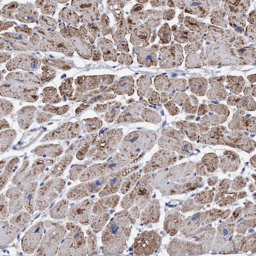 Immunohistochemical staining of human heart muscle shows strong cytoplasmic positivity in myocytes.