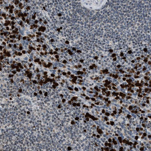 Immunohistochemical staining of human spleen shows strong nuclear and cytoplasmic positivity in cells of the red pulp.