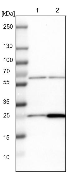 Lane 1: NIH-3T3 cell lysate (Mouse embryonic fibroblast cells)<br/>Lane 2: NBT-II cell lysate (Rat Wistar bladder tumour cells)