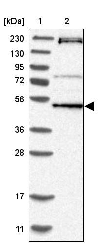 Lane 1: Marker [kDa] 230, 130, 95, 72, 56, 36, 28, 17, 11<br/>Lane 2: Human cell line RT-4