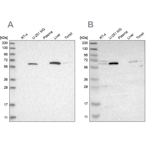 Western blot analysis using Anti-CRAT antibody HPA022815 (A) shows similar pattern to independent antibody HPA019230 (B).