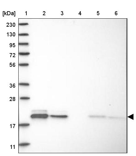 Lane 1: Marker [kDa] 230, 130, 95, 72, 56, 36, 28, 17, 11<br/>Lane 2: Human cell line RT-4<br/>Lane 3: Human cell line U-251MG sp<br/>Lane 4: Human plasma (IgG/HSA depleted)<br/>Lane 5: Human liver tissue<br/>Lane 6: Human tonsil tissue