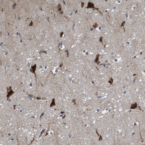 Immunohistochemical staining of human cerebral cortex shows strong cytoplasmic positivity in neuronal and glial cells.