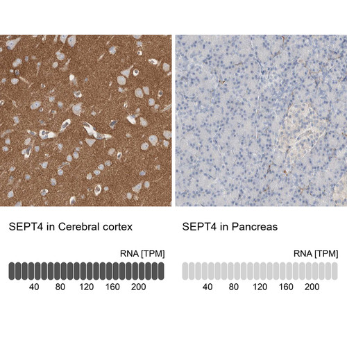 Immunohistochemistry analysis in human cerebral cortex and pancreas tissues using HPA022905 antibody. Corresponding SEPT4 RNA-seq data are presented for the same tissues.