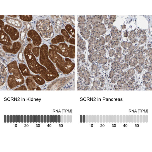 Immunohistochemistry analysis in human kidney and pancreas tissues using Anti-SCRN2 antibody. Corresponding SCRN2 RNA-seq data are presented for the same tissues.
