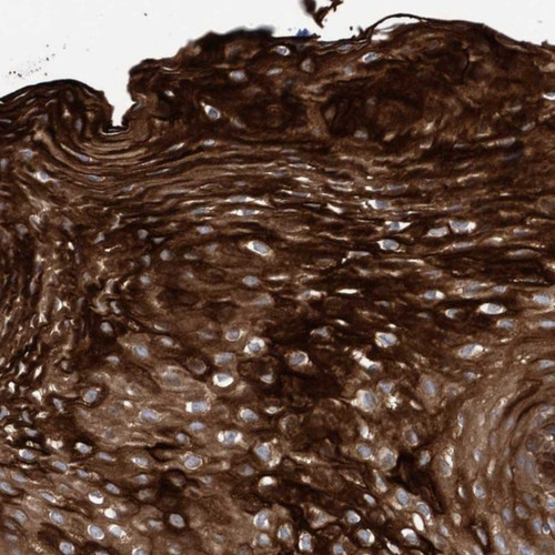 Immunohistochemical staining of human esophagus shows strong cytoplasmic positivity in squamous epithelial cells.