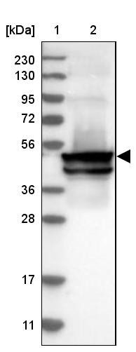 Lane 1: Marker [kDa] 230, 130, 95, 72, 56, 36, 28, 17, 11<br/>Lane 2: Human cell line RT-4