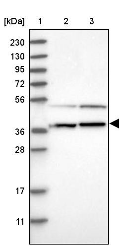 Lane 1: Marker [kDa] 230, 130, 95, 72, 56, 36, 28, 17, 11<br/>Lane 2: Human cell line RT-4<br/>Lane 3: Human cell line U-251MG sp