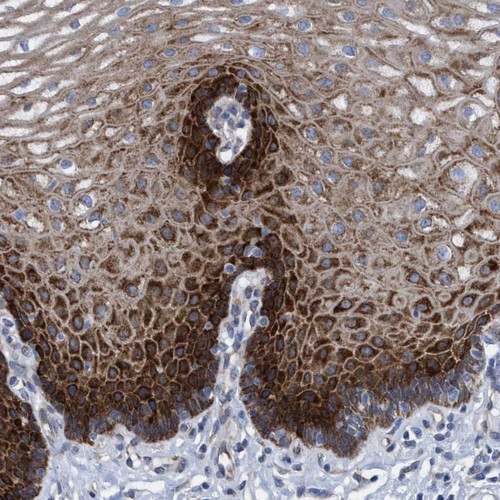 Immunohistochemical staining of human esophagus shows strong cytoplasmic positivity in squamous epithelial cells.