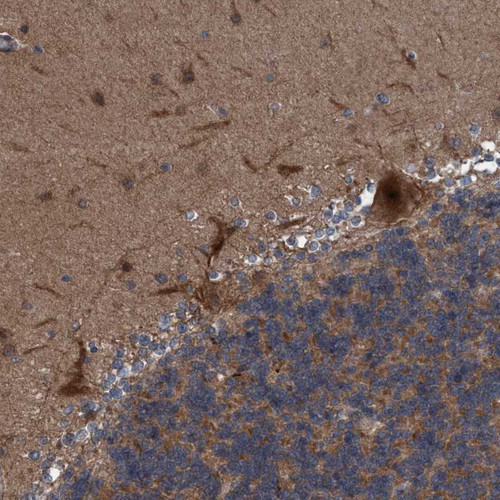 Immunohistochemical staining of human cerebellum shows strong cytoplasmic and membranous positivity in Purkinje cells.