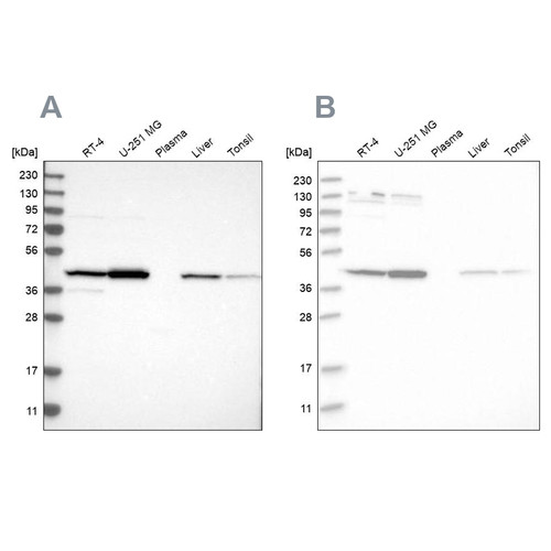 Western blot analysis using Anti-CNP antibody HPA023280 (A) shows similar pattern to independent antibody HPA023266 (B).