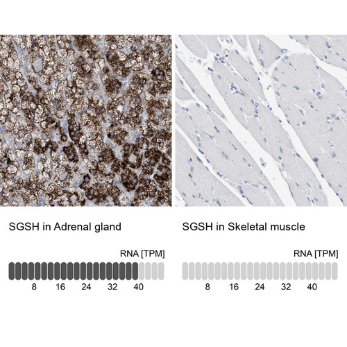Immunohistochemistry analysis in human adrenal gland and skeletal muscle tissues using HPA023436 antibody. Corresponding SGSH RNA-seq data are presented for the same tissues.