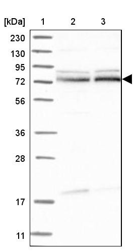 Lane 1: Marker [kDa] 230, 130, 95, 72, 56, 36, 28, 17, 11<br/>Lane 2: Human cell line RT-4<br/>Lane 3: Human cell line U-251MG sp