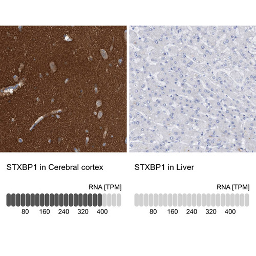 Immunohistochemistry analysis in human cerebral cortex and liver tissues using HPA023483 antibody. Corresponding STXBP1 RNA-seq data are presented for the same tissues.