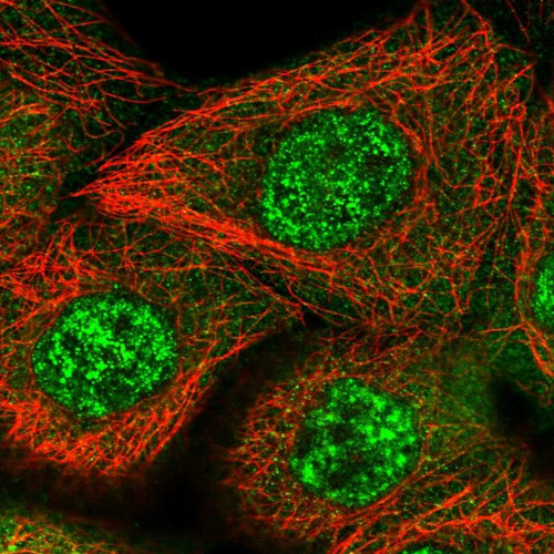 Immunofluorescent staining of human cell line A-431 shows localization to nuclear speckles & cytosol.