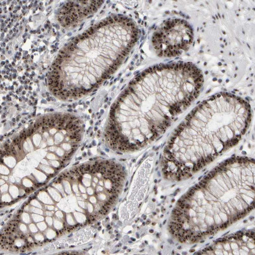 Immunohistochemical staining of human colon shows strong nucleolar positivity in glandular cells.