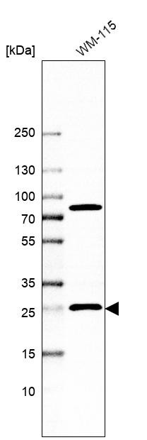 Western blot analysis in human cell line WM-115.