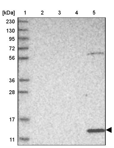 Lane 1: Marker [kDa] 230, 130, 95, 72, 56, 36, 28, 17, 11<br/>Lane 2: Human cell line RT-4<br/>Lane 3: Human cell line U-251MG sp<br/>Lane 4: Human plasma (IgG/HSA depleted)<br/>Lane 5: Human liver tissue