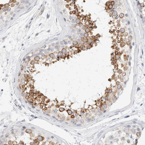 Immunohistochemical staining of human testis shows strong cytoplasmic positivity in seminiferous ducts cells.