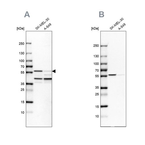 Western blot analysis using Anti-PHGDH antibody HPA024031 (A) shows similar pattern to independent antibody HPA021241 (B).