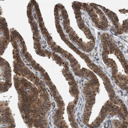 Immunohistochemical staining of human fallopian tube shows cytoplasmic and nuclear positivity in glandular cells.