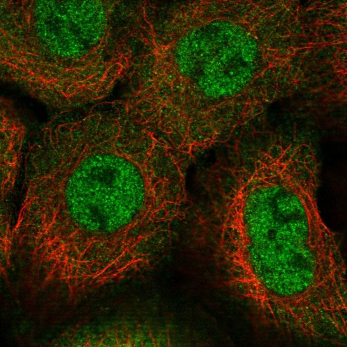 Immunofluorescent staining of human cell line A-431 shows localization to nucleoplasm & cytosol.