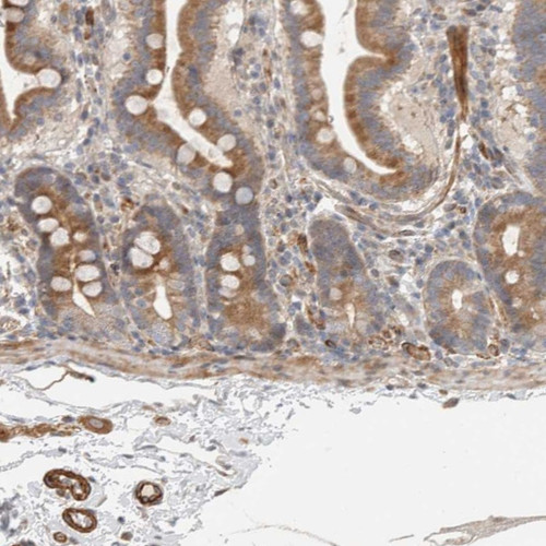 Immunohistochemical staining of human duodenum shows moderate cytoplasmic positivity in glandular cells.