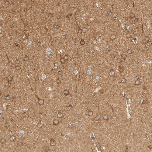 Immunohistochemical staining of human cerebral cortex shows moderate cytoplasmic positivity in neuronal cells and neuropil.