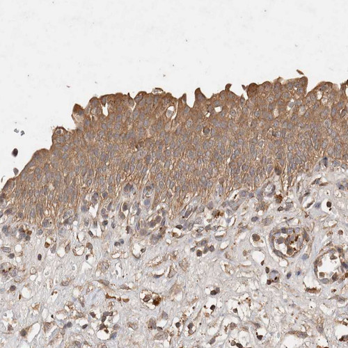 Immunohistochemical staining of human Urinary bladder shows moderate cytoplasmic positivity in urothelial cells.