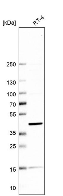 Western blot analysis in human cell line RT-4.