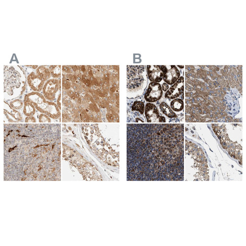 Immunohistochemical staining of human kidney, liver, lymph node and testis using Anti-TACO1 antibody HPA024294 (A) shows similar protein distribution across tissues to independent antibody HPA021626 (B).