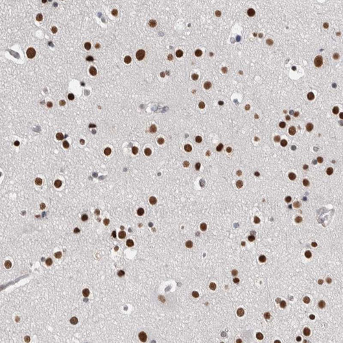 Immunohistochemical staining of human cerebral cortex shows strong nuclear positivity in neuronal cells and glial cells.